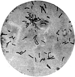 Bacillus of tuberculosis