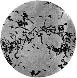 Bacillus of diphteria