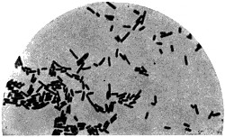 Bacillus of typhoid